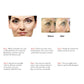 Micro Needle 540 Roller Derma Roller Anti Hair Loss Treatment.